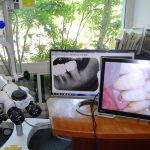 横浜山手デンタルクリニック 手術用顕微鏡と治療動画
