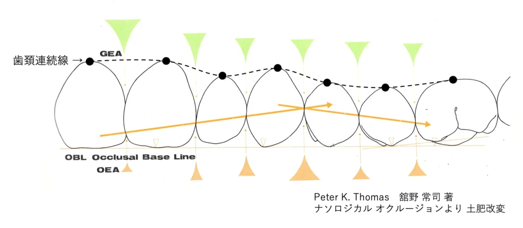 歯頚連続線 美しい歯並びのライン  横浜の歯科・歯医者 横浜山手デンタルクリニック